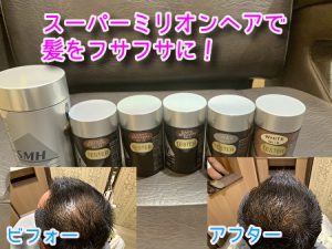 スーパーミリオンヘアーの使い方 口コミ 感想 色についてのご紹介 育毛 理容師が伝える効果のある育毛